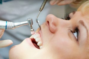 Patient undergoes dental cleaning and consultation