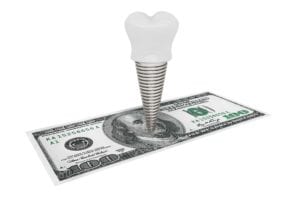 Dental implant hovering over a one hundred dollar bill