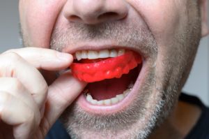 Man placing a red mouth guard into his mouth 