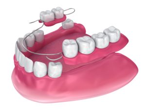 A Quick Guide To The World Of Dentures