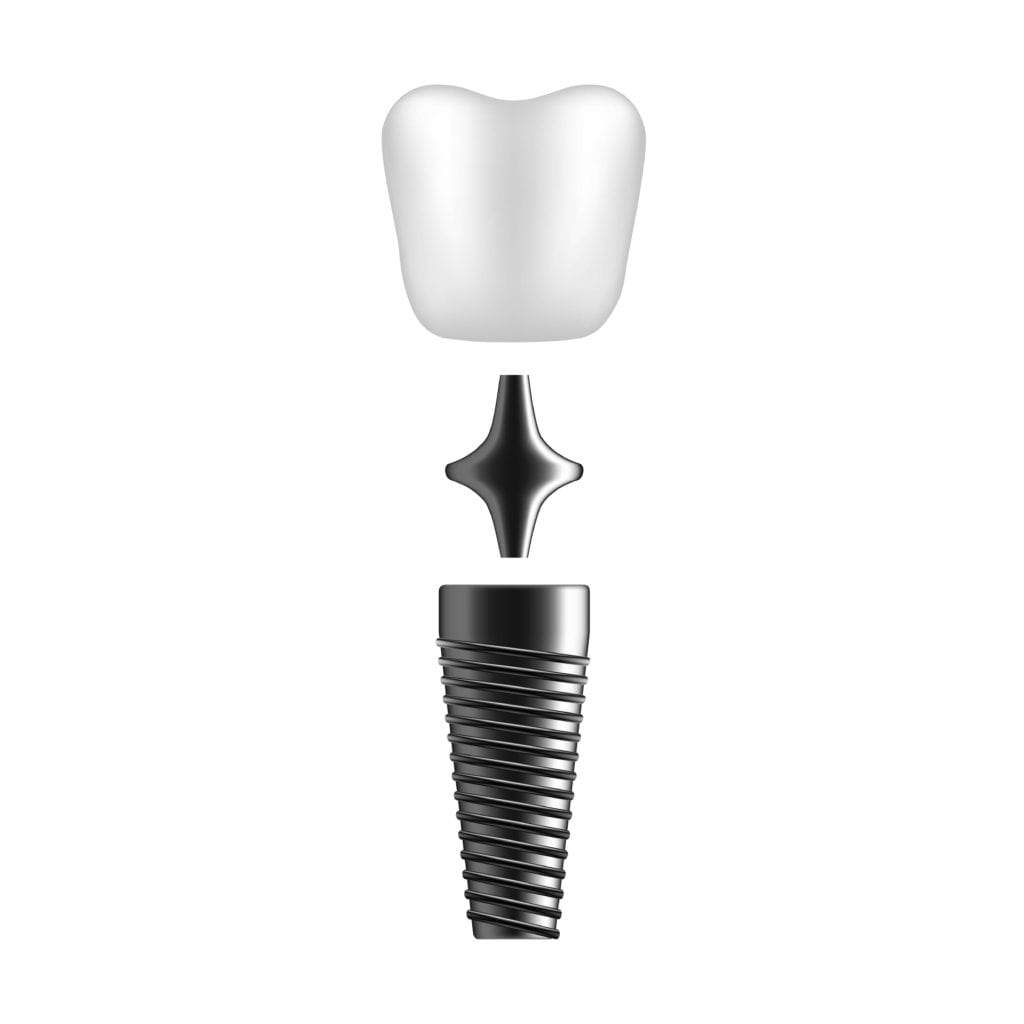 Dental implant with abutment and dental crown