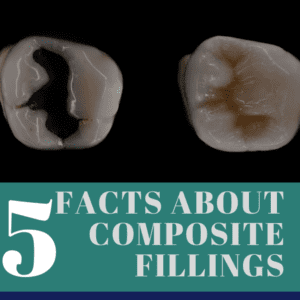 Title banner for "5 facts about composite fillings"
