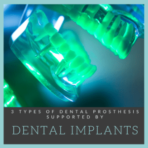 3 Dental Prosthesis Supported by Dental Implants