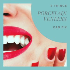 5 Things Porcelain Veneers Can Fix