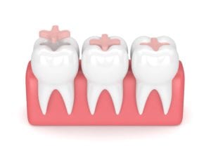 Big Dental teeth