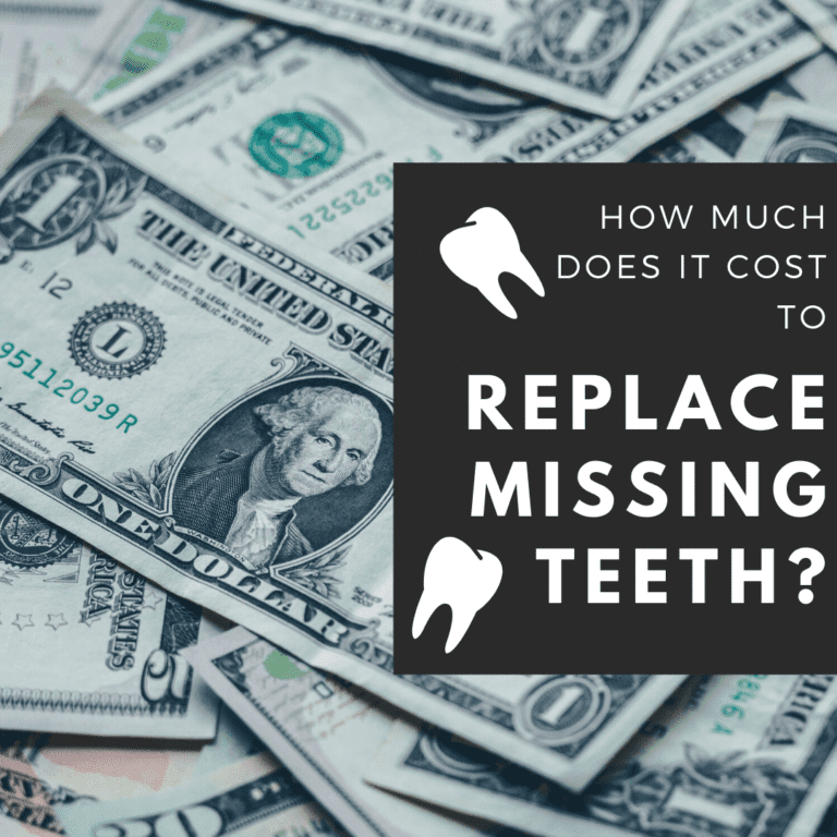 Cost to Replace Missing Teeth