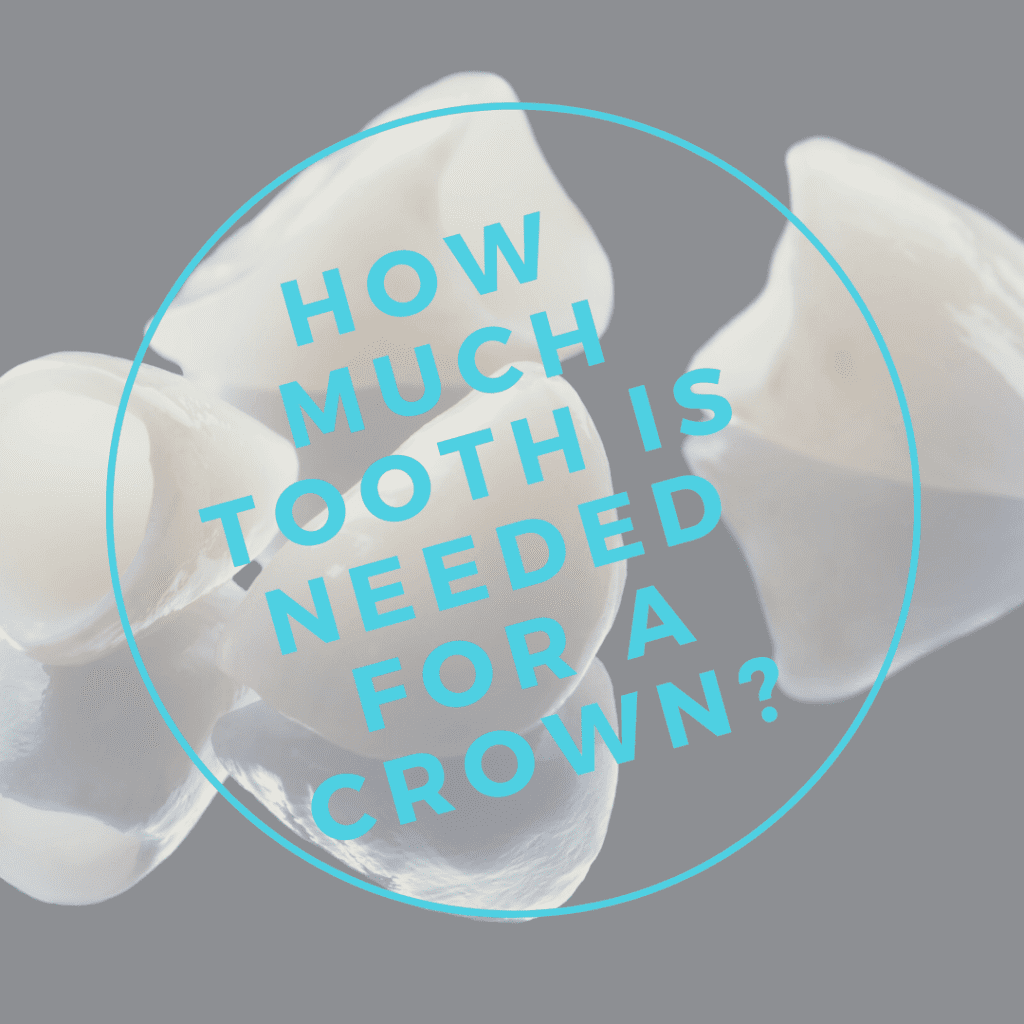 How Much Tooth is Needed for a Crown?