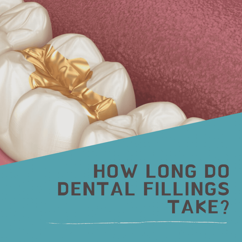 How Long Do Dental Fillings Take?