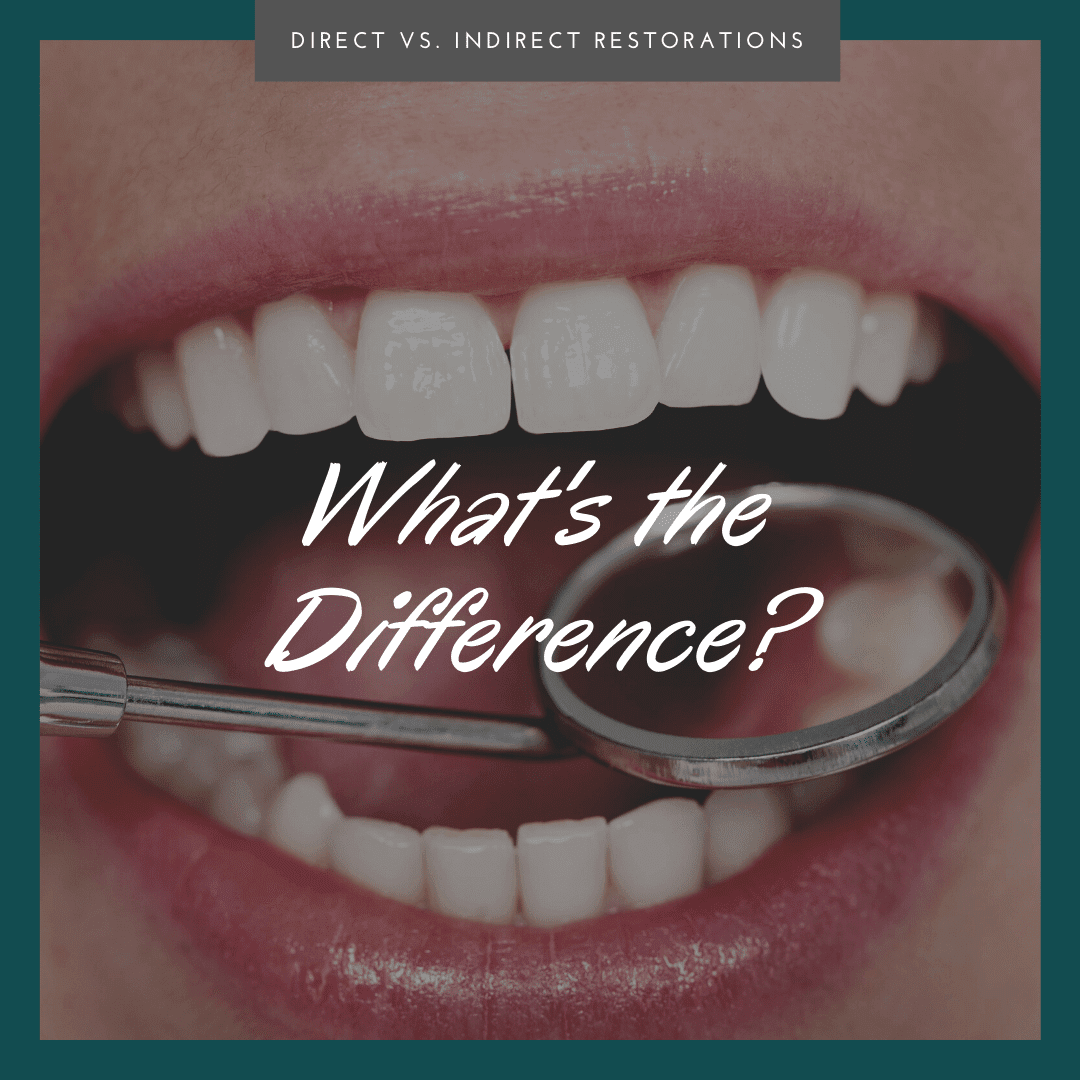 Direct vs. Indirect Restorations What's the Difference?