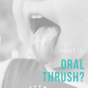 What is Oral Thrush?