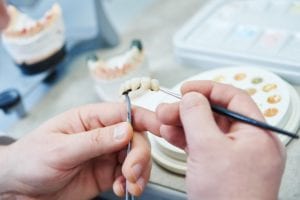 dental restoration being fabricated