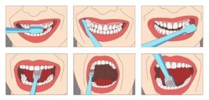 steps showing how to brush your teeth