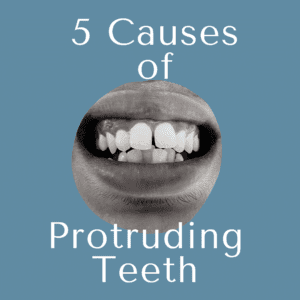 5 Causes of Protruding Teeth