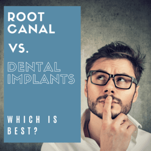 Root Canal Vs. Dental Implants