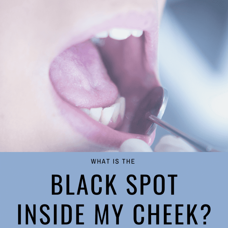 redde molester Gensidig What is the Black Spot on the Inside of my Cheek?