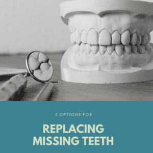 3 Options for Replacing Missing Teeth