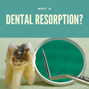 What is Dental Resorption?