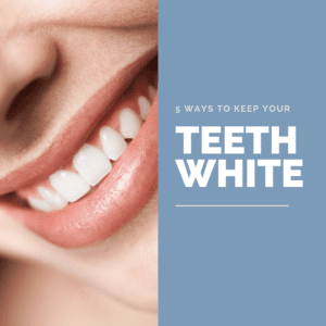 How to Keep Your Teeth White