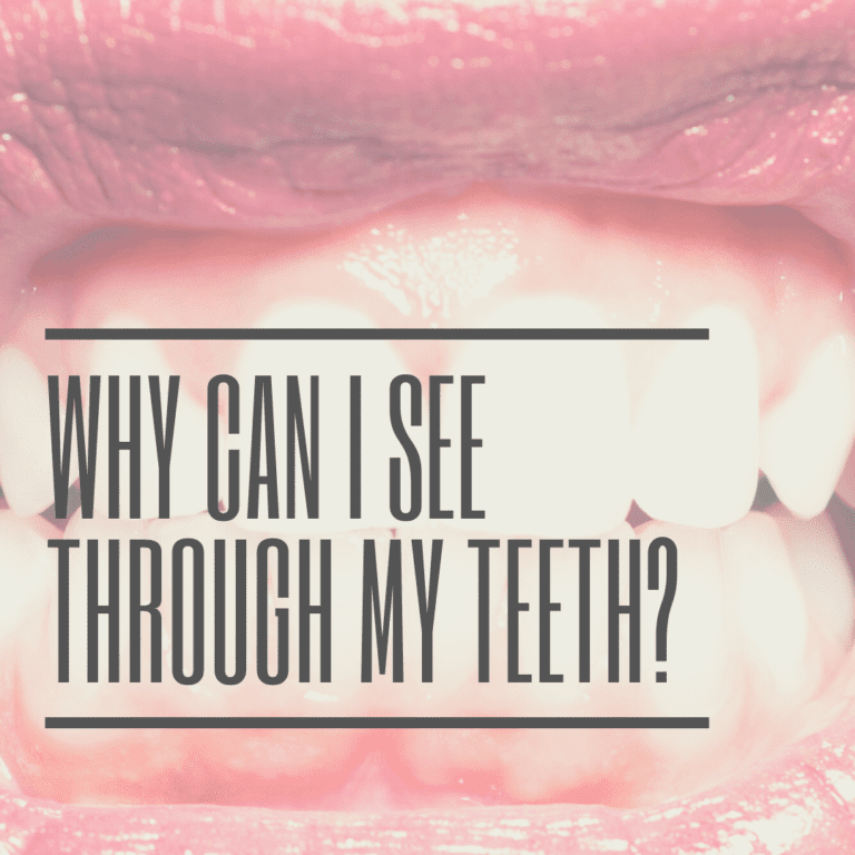Why Can I See Through My Teeth?