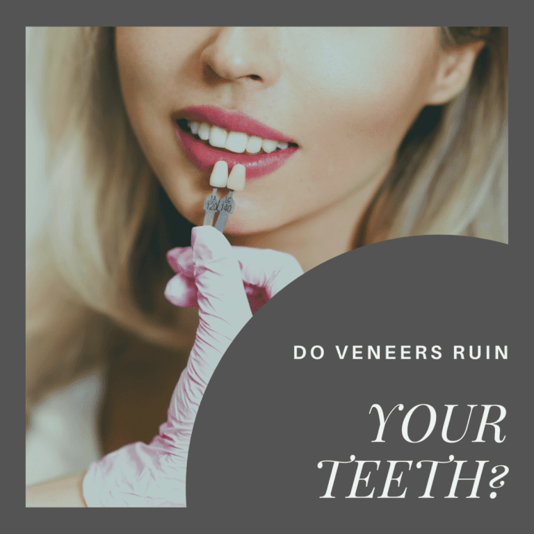 Do Veneers Ruin your teeth2
