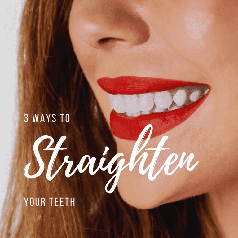 3 Ways to Straighten Your Teeth