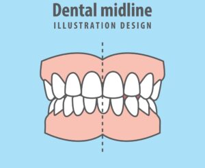 dental midline