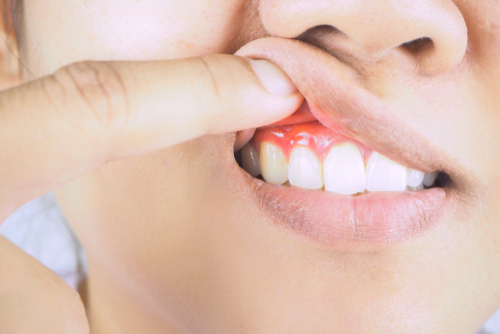 Gum Disease Treatment - diagnosing gum disease at Bethesda 