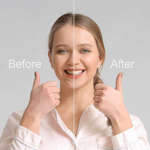 Smile Makeover - correcting your smile that you can be happy with