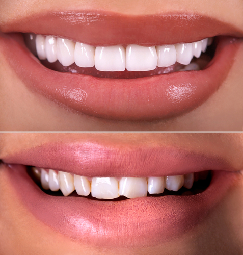 Restorative Dentistry - helping to get your oral health problems fixed to have a great smile