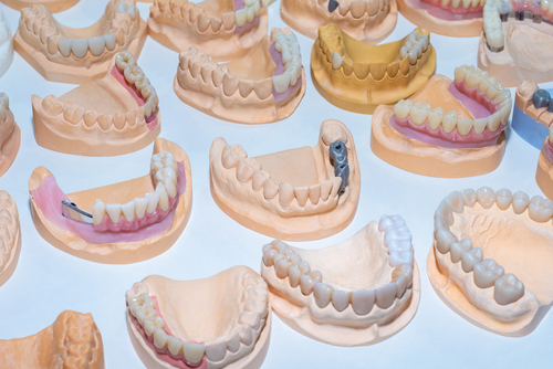 Dentures - at Bethesda they offer different kinds of dentures and helps you determine which is best for you