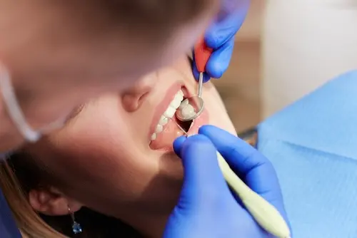Cavity Prevention Methods - Bethesda Family Dentistry