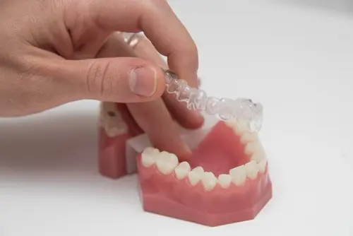 Invisalign - How Does Invisalign work?