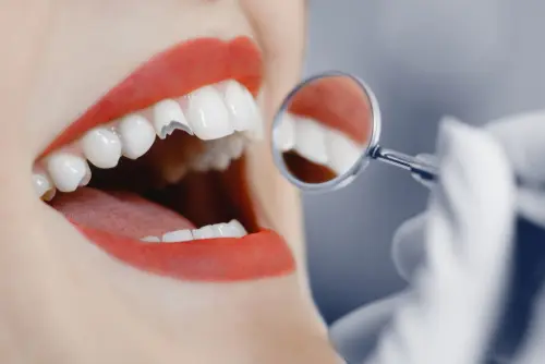 Broken Tooth - Bethesda Family Dentistry