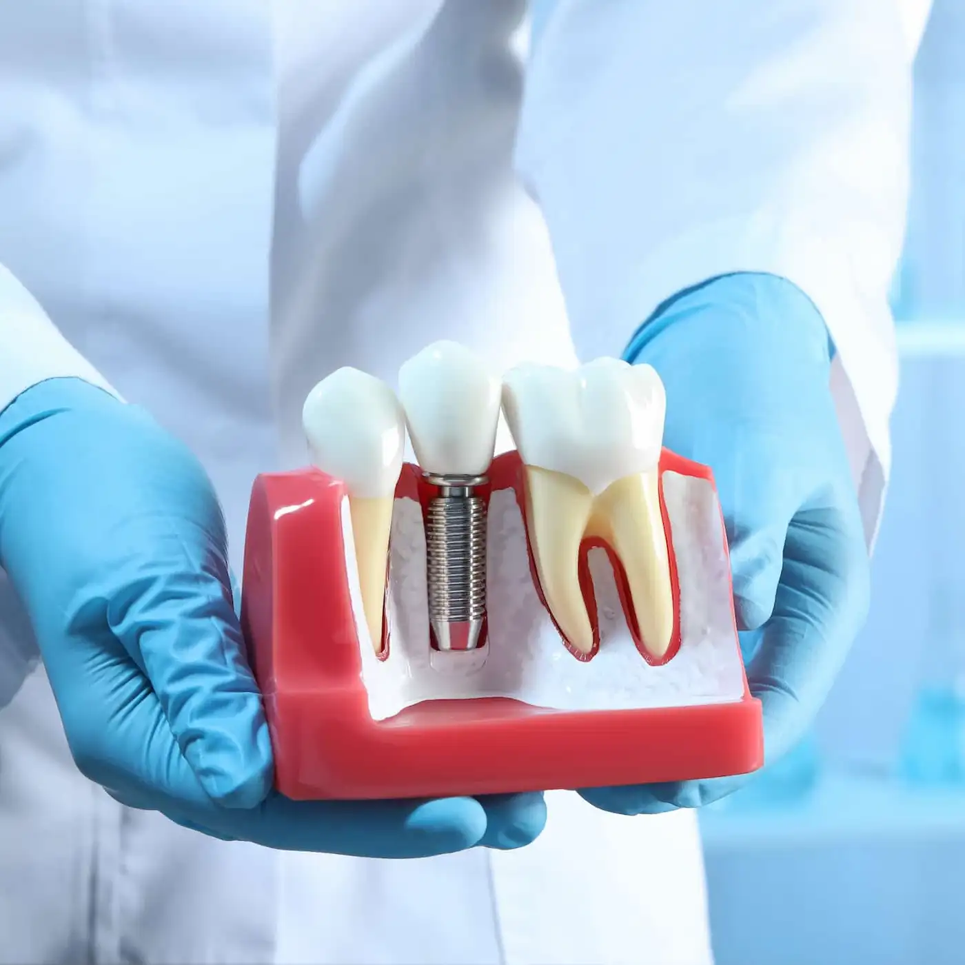 Dental Implant Placement at Bethesda Family Dental